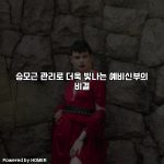 승모근 관리로 더욱 빛나는 예비신부의 비결 [요약]
